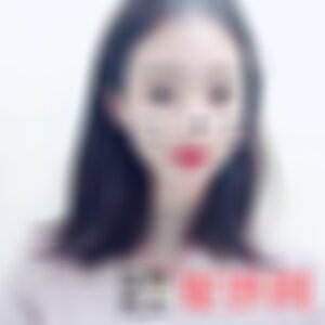 湖南省人民医院是正规的吗?附2021较新整形案例