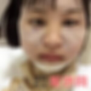 湖南省人民医院是正规的吗?附2021较新整形案例
