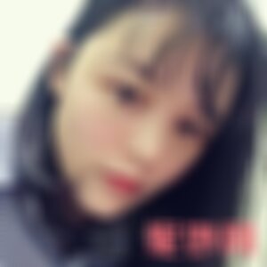 红河爱尔眼科医院有限公司是私立医院吗？附2021较新整形案例