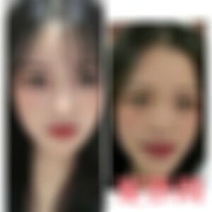 福州美莱华美美容医院是正规医院吗?