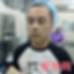 苏州美莱美容医院是公立医院吗？附2021年较新价格表