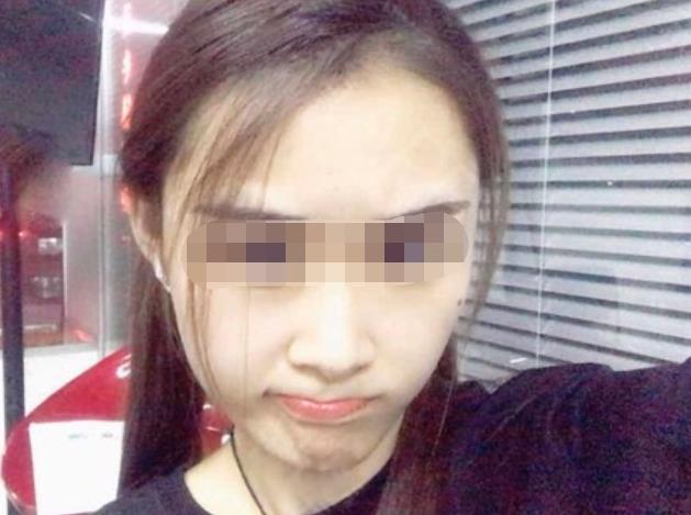 m22和皮秒哪个好？两者功效作用一样吗？附m22案例和价格表！