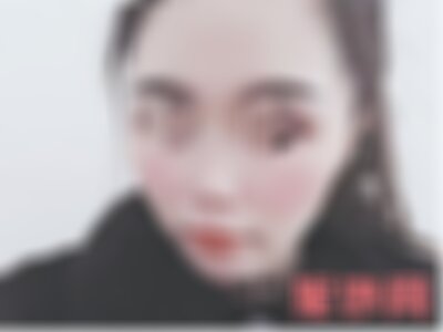 云南铜雀台的超皮秒靠谱吗