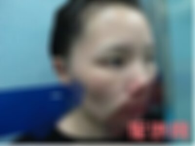 云南铜雀台的超皮秒靠谱吗