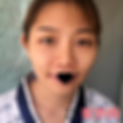昆明艺星隆鼻怎么样