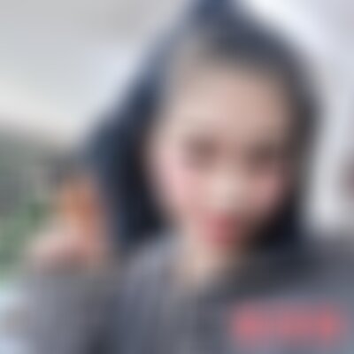 昆明艺星皮秒激光祛斑多少钱