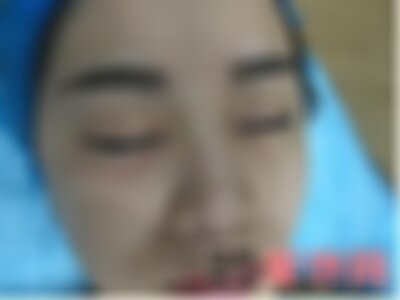 金华丽都整形皮肤科皮秒怎么样