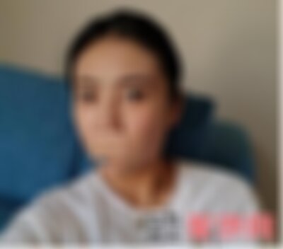 柳州华美皮秒怎么样