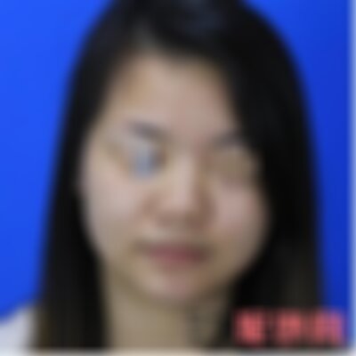 昆明梦想整形医院隆鼻怎么样