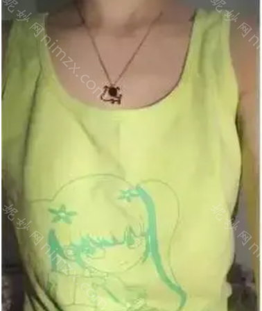 杭州艺星医疗美容医院万连壮做隆胸效果怎么样?附真人案例效果图