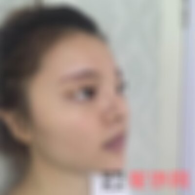 济南海峡改脸型怎么样