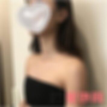 昆明艺星假体隆胸怎么样