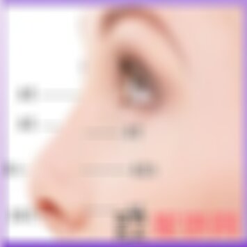昆明艺星做鼻综合怎么样