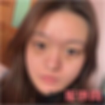 昆明艺星整形去眼袋怎么样
