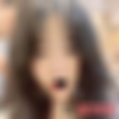 昆明艺星整容医院植发怎么样