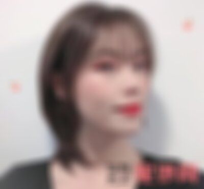 昆明艺星整容医院植发怎么样