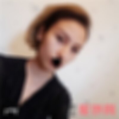 昆明艺星整形光子嫩肤怎么样