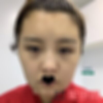 昆明艺星瘦脸*怎么样