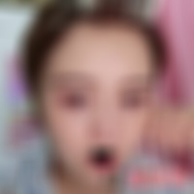 昆明艺星瘦脸*怎么样