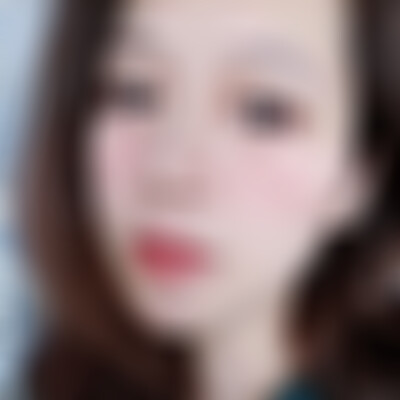 云南华美美莱重度下垂眼修复做得好吗