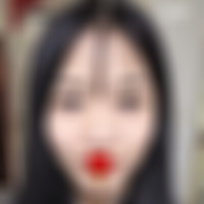 云南华美美莱祛痣好不好