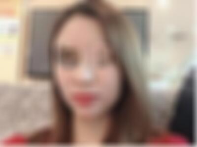 云南华美脂肪填充面部怎么样