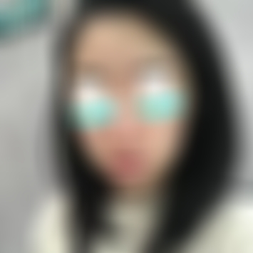 云南华美热玛吉怎么样