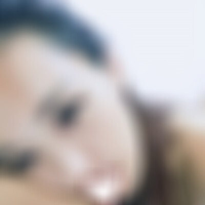 云南华美美莱开眼角怎么样