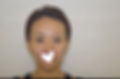 云南华美美莱开眼角怎么样