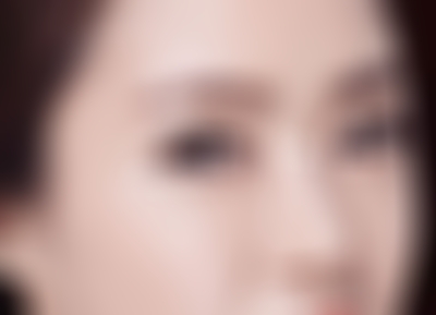 云南华美美莱开眼角怎么样