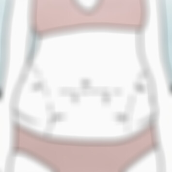贵阳美贝尔抽脂多少钱