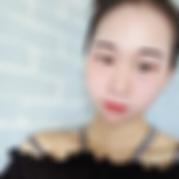 贵阳美贝尔祛痣怎么样
