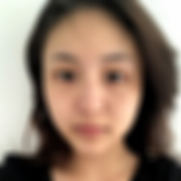 贵阳美贝尔做鼻子好嘛