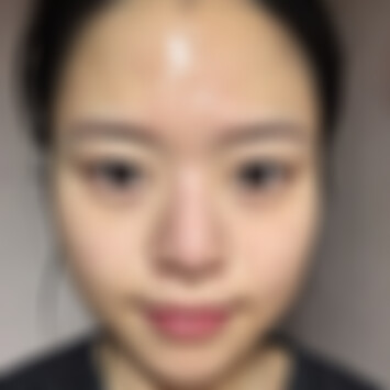 贵阳美贝尔热玛吉效果好不好