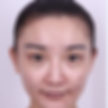 贵阳美贝尔医院果酸价格是多少