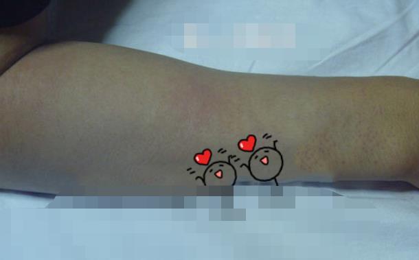 深圳赫思医疗美容是正规医院吗？做激光脱毛行吗，附案例价格表！