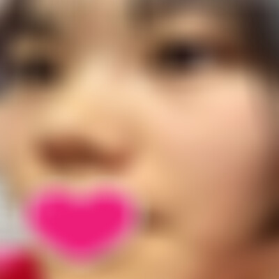 广州华美医疗美容祛斑怎么样