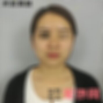北京华韩医疗美容医院皮秒祛斑好不好