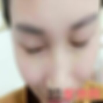 北京华韩睫毛种植怎么样