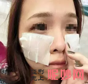 深圳北大整形医院打玻尿酸怎么样