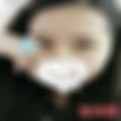 宝鸡高一生做双眼皮怎么样