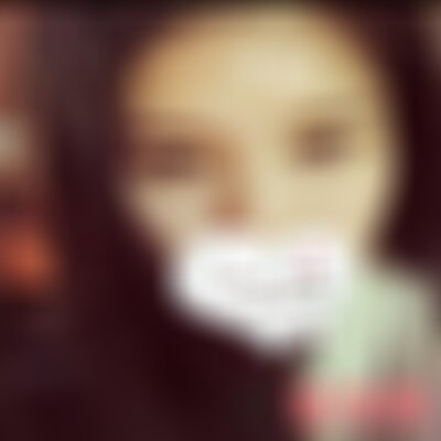 宝鸡高一生做双眼皮怎么样