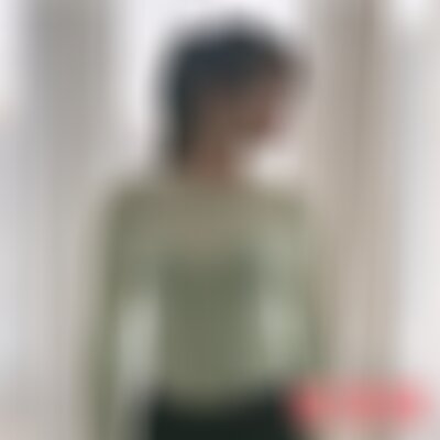 北京东方和谐无针吸脂怎么样