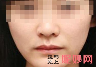北大口腔梁成怎么样？做颌面整形好不好，附案例和价格表！