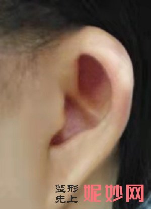 重庆耳畸形大约多少钱，这篇文章告诉你答案