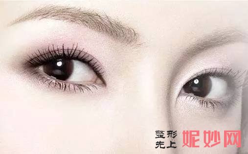 广州曙光医院双眼皮价格表