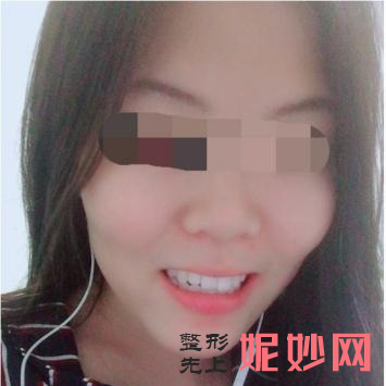 北京中诺口腔医院箍牙好吗