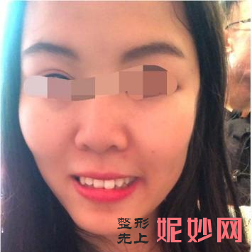 北京中诺口腔医院箍牙好吗