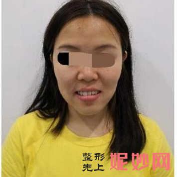 北京中诺口腔医院箍牙好吗