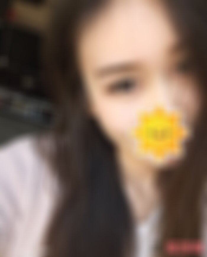 沈阳杏林美容整形医院开眼角怎么样